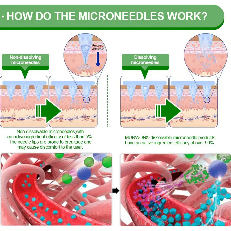 ๐ ๐จ๐ฅ๐ช๐ข๐กยฎ ๐๐๐ซ๐๐๐ซ๐ข๐ง๐ 10-๐ข๐ง-๐ ๐๐๐ง๐จ ๐๐ข๐๐ซ๐จ๐ง๐๐๐๐ฅ๐ ๐๐๐ญ๐๐ก
