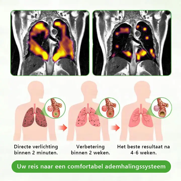 ๐ ๐๐๐ค๐๐ยฎ Botanische koningskaars longreinigingsdiffuser