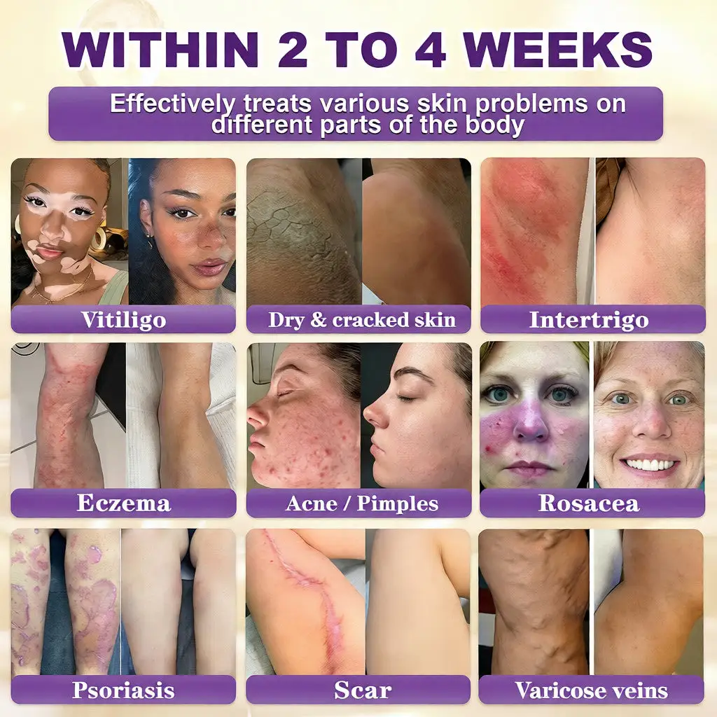 ๐ ๐จ๐ฅ๐ช๐ฌ๐กยฎ Biotin 10-in-1 Skin Restoration Cream