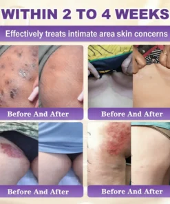 ๐ ๐จ๐ฅ๐ช๐ฌ๐กยฎ Biotin 10-in-1 Skin Restoration Cream