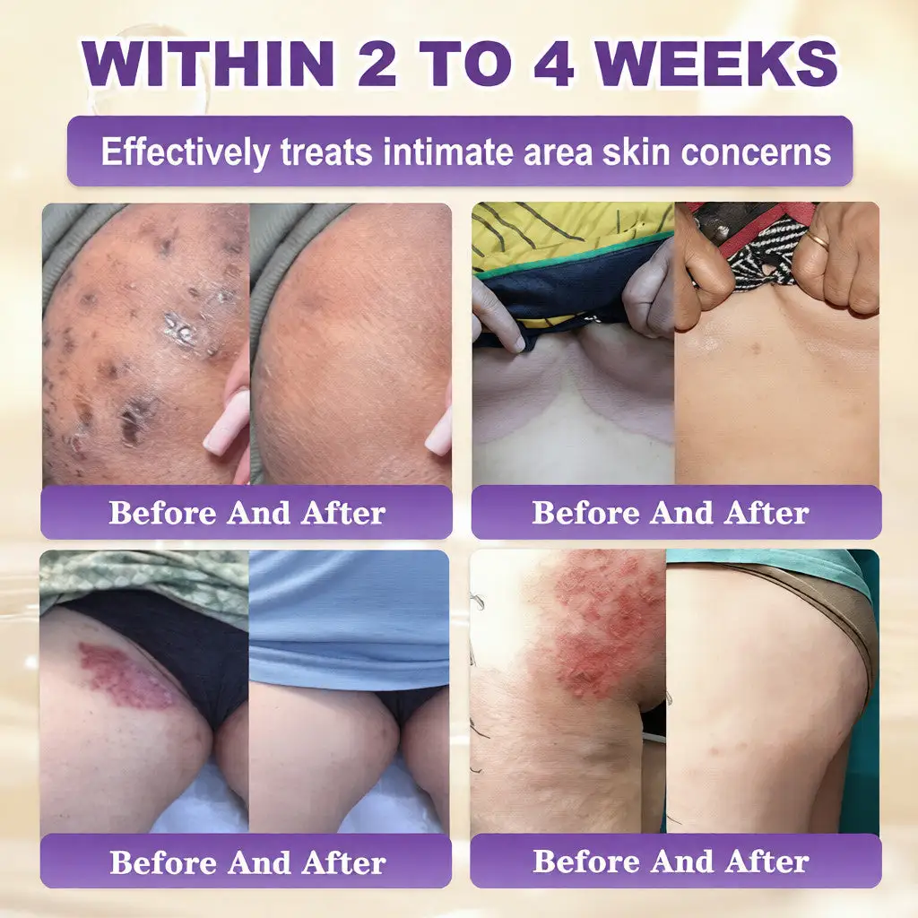 ๐ ๐จ๐ฅ๐ช๐ฌ๐กยฎ Biotin 10-in-1 Skin Restoration Cream