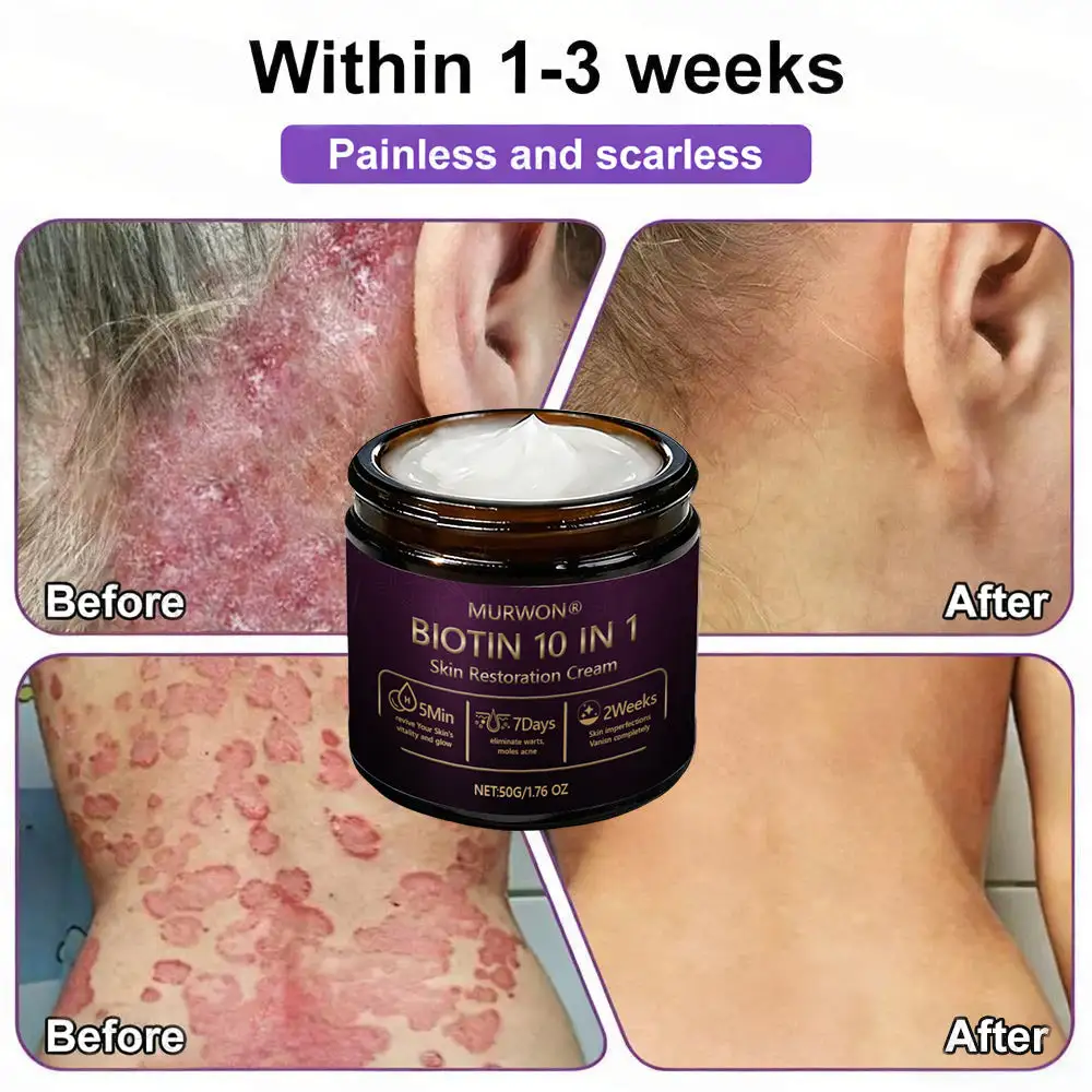 ๐ ๐จ๐ฅ๐ช๐ฌ๐กยฎ Biotin 10-in-1 Skin Restoration Cream