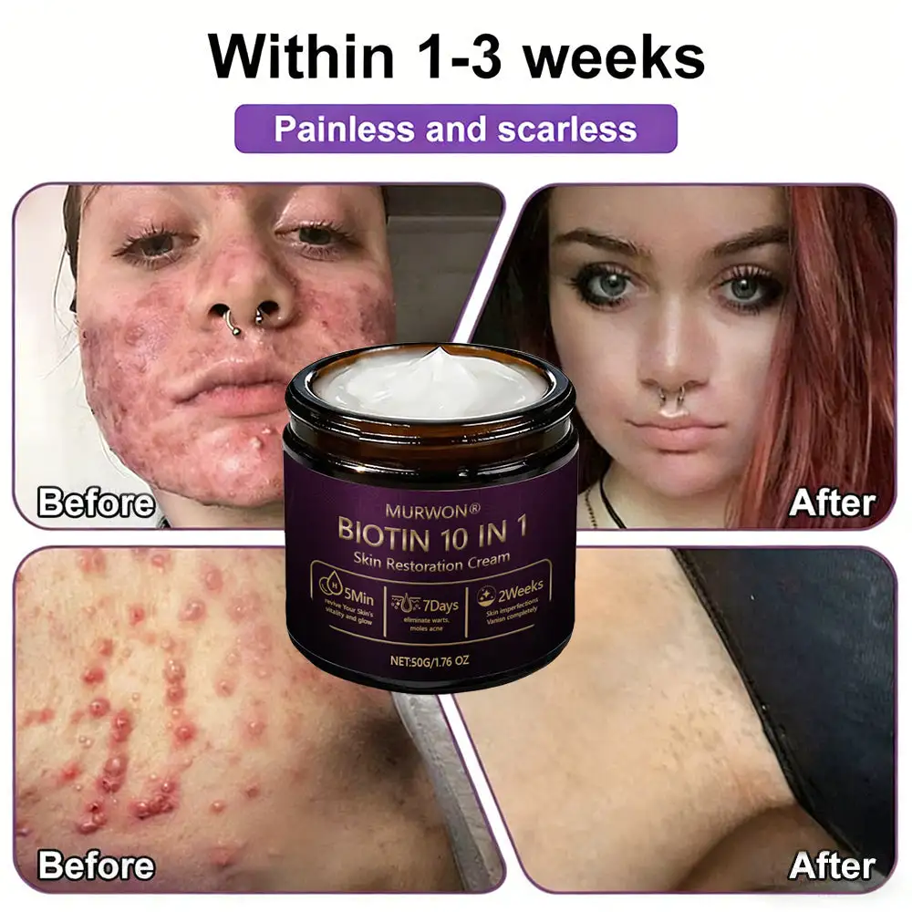 ๐ ๐จ๐ฅ๐ช๐ฌ๐กยฎ Biotin 10-in-1 Skin Restoration Cream