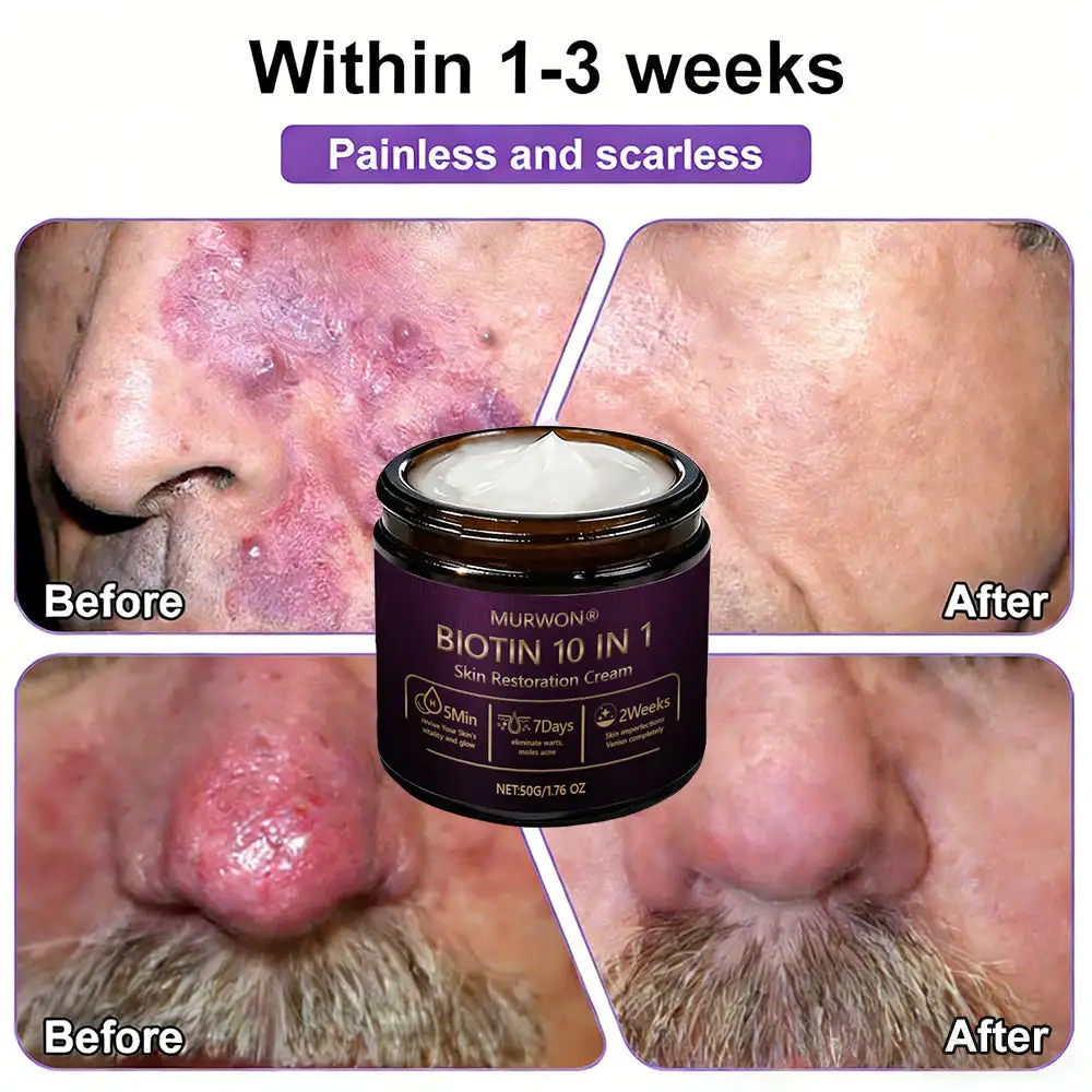 ๐ ๐จ๐ฅ๐ช๐ฌ๐กยฎ Biotin 10-in-1 Skin Restoration Cream