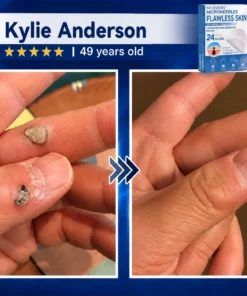 MURWON® Advanced Microneedle Patch