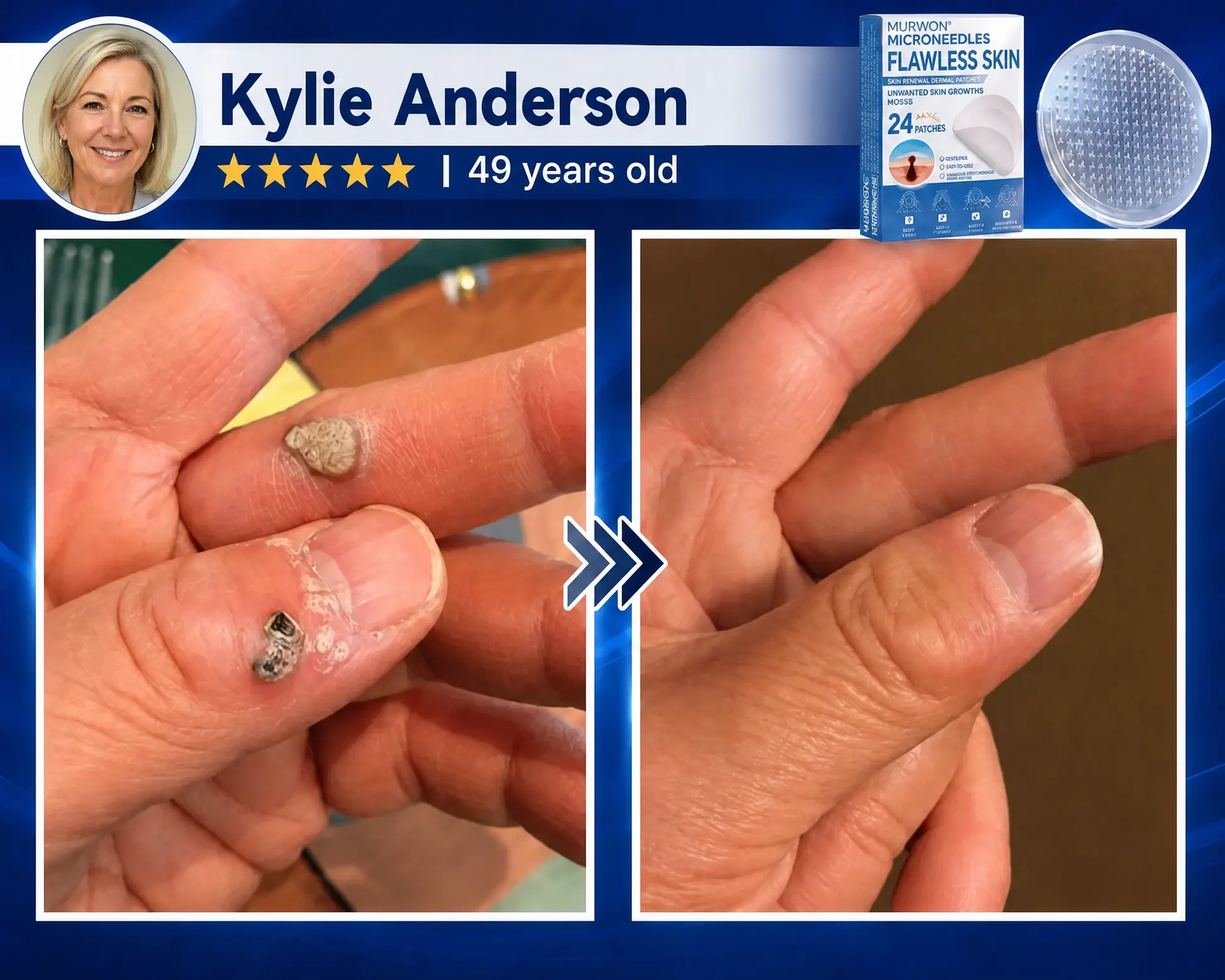 MURWON® Advanced Microneedle Patch