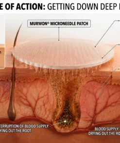 MURWON® Advanced Microneedle Patch